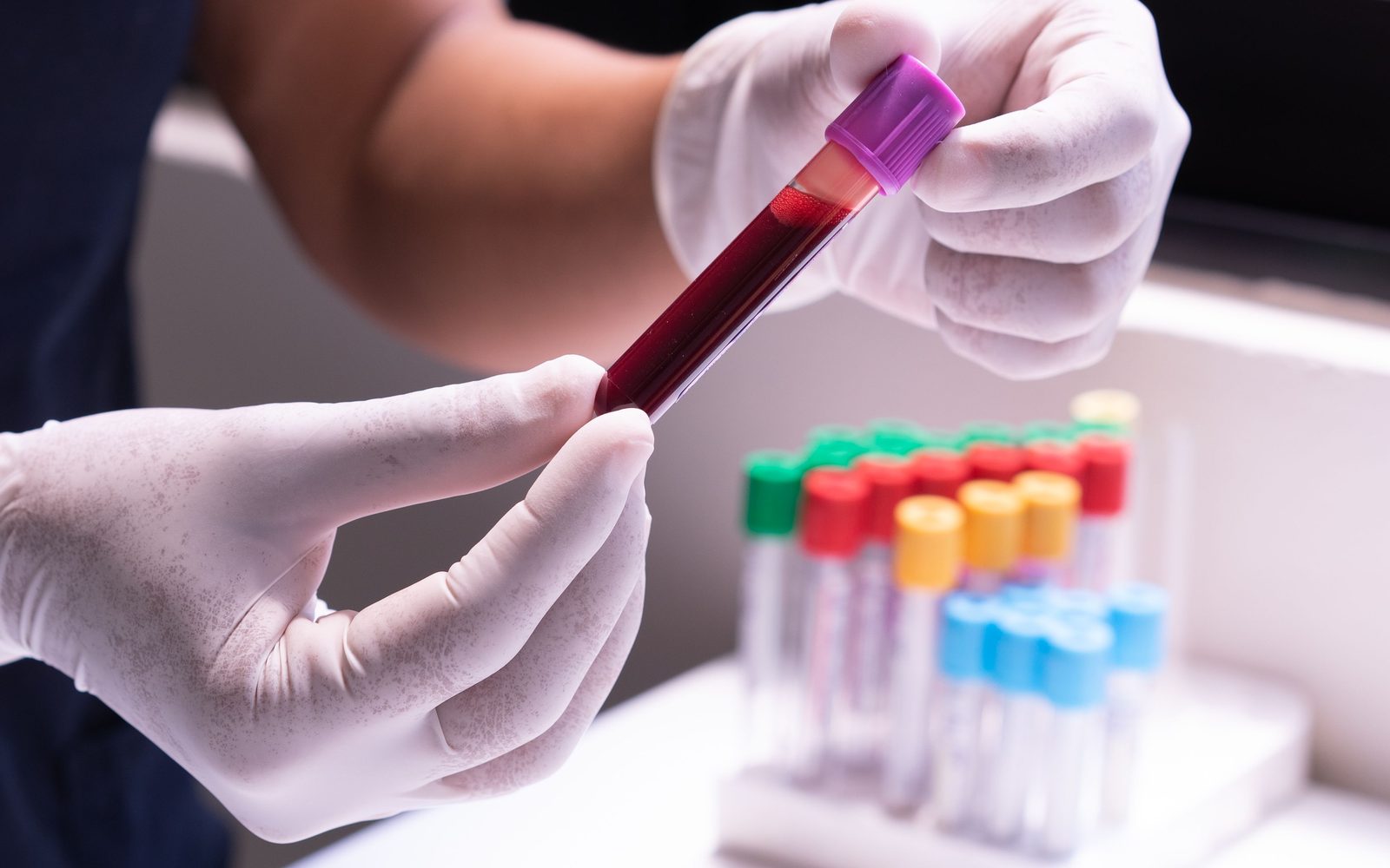 Understanding your blood test results